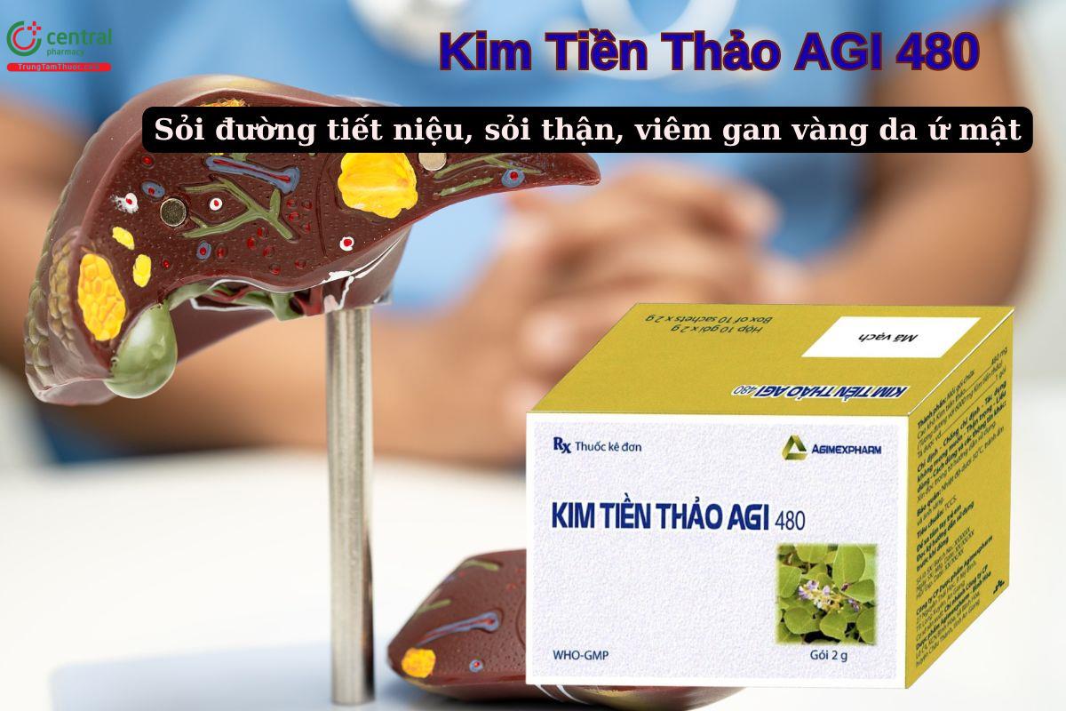 Thuốc Kim Tiền Thảo AGI 480 chỉ định cho người bệnh sỏi tiết niệu, sỏi thận,...