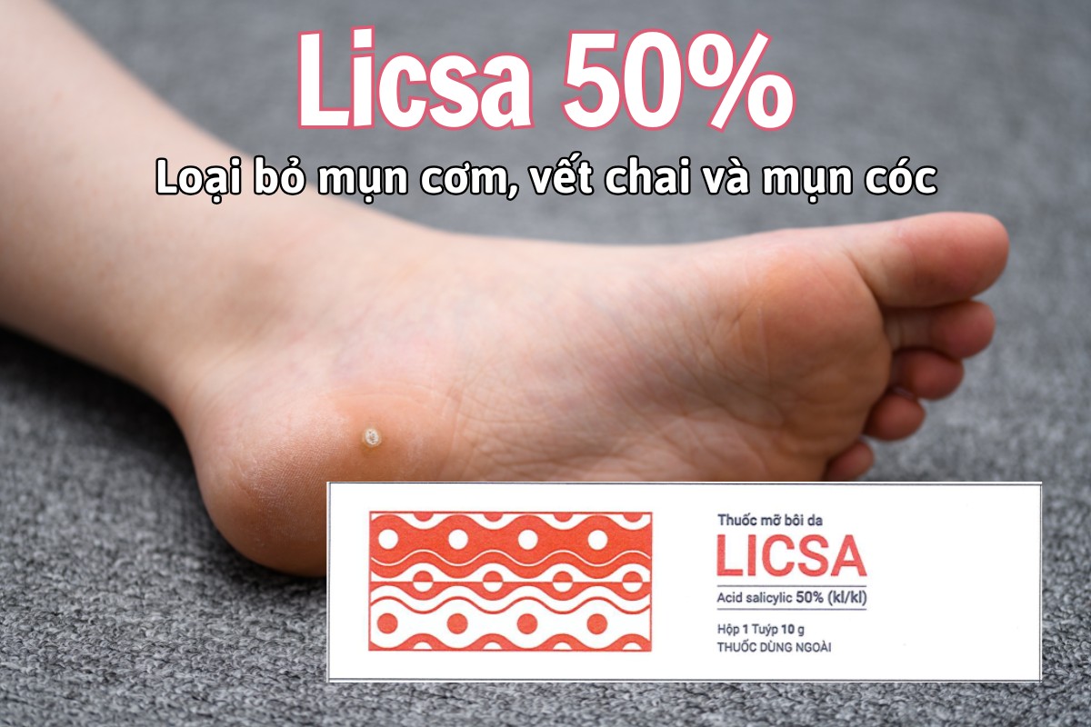 Thuốc Licsa 50% điều trị bệnh da tăng sừng hóa, loại bỏ mụn cơm, vết chai và mụn cóc