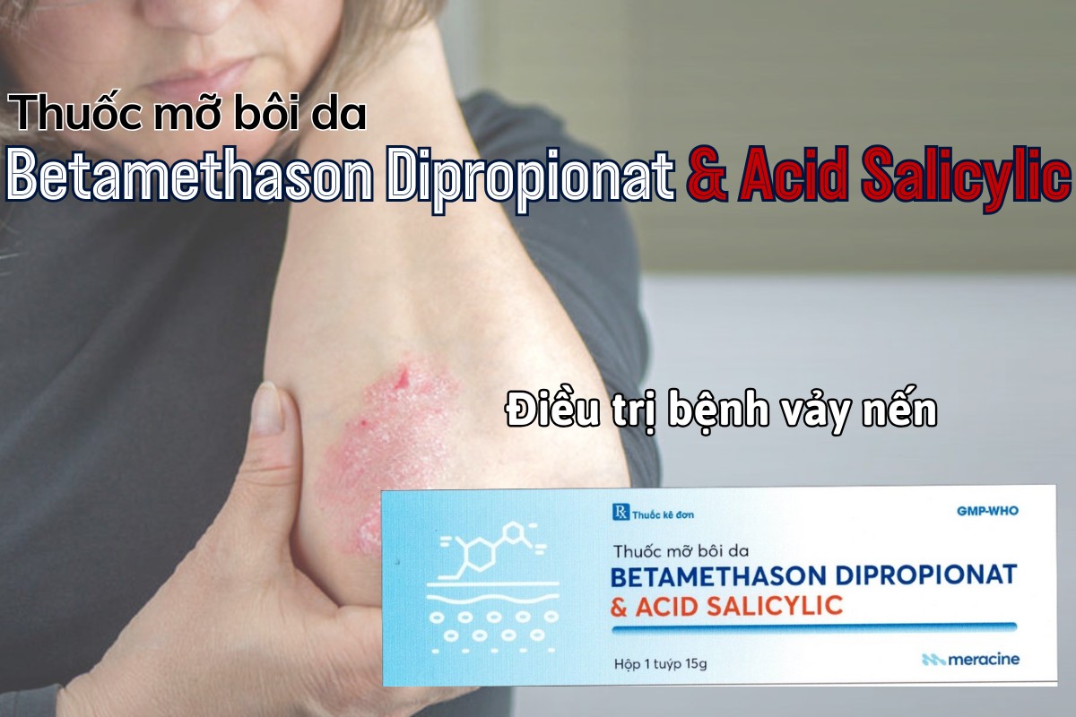 Thuốc Mỡ Bôi Da Betamethason Dipropionat & Acid Salicylic điều trị bệnh vảy nến