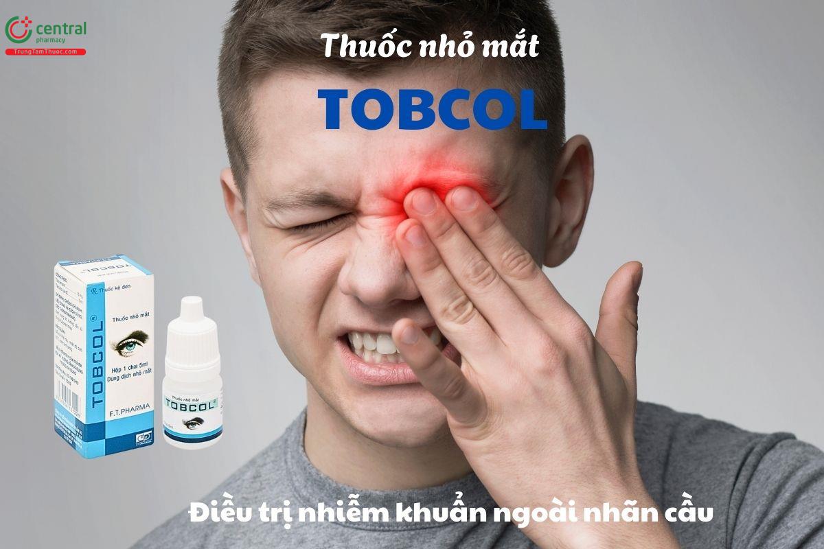 Chỉ định của thuốc nhỏ mắt Tobcol 5ml