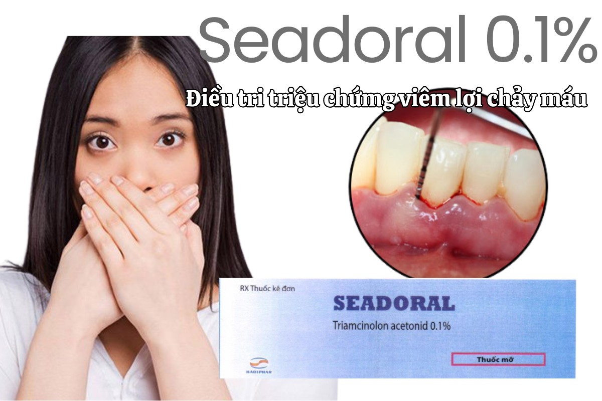 Thuốc Seadoral 0.1% điều trị triệu chứng viêm lợi chảy máu