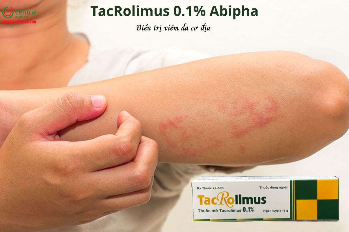 Thuốc TacRolimus 0.1% Abipha điều trị viêm da cơ địa