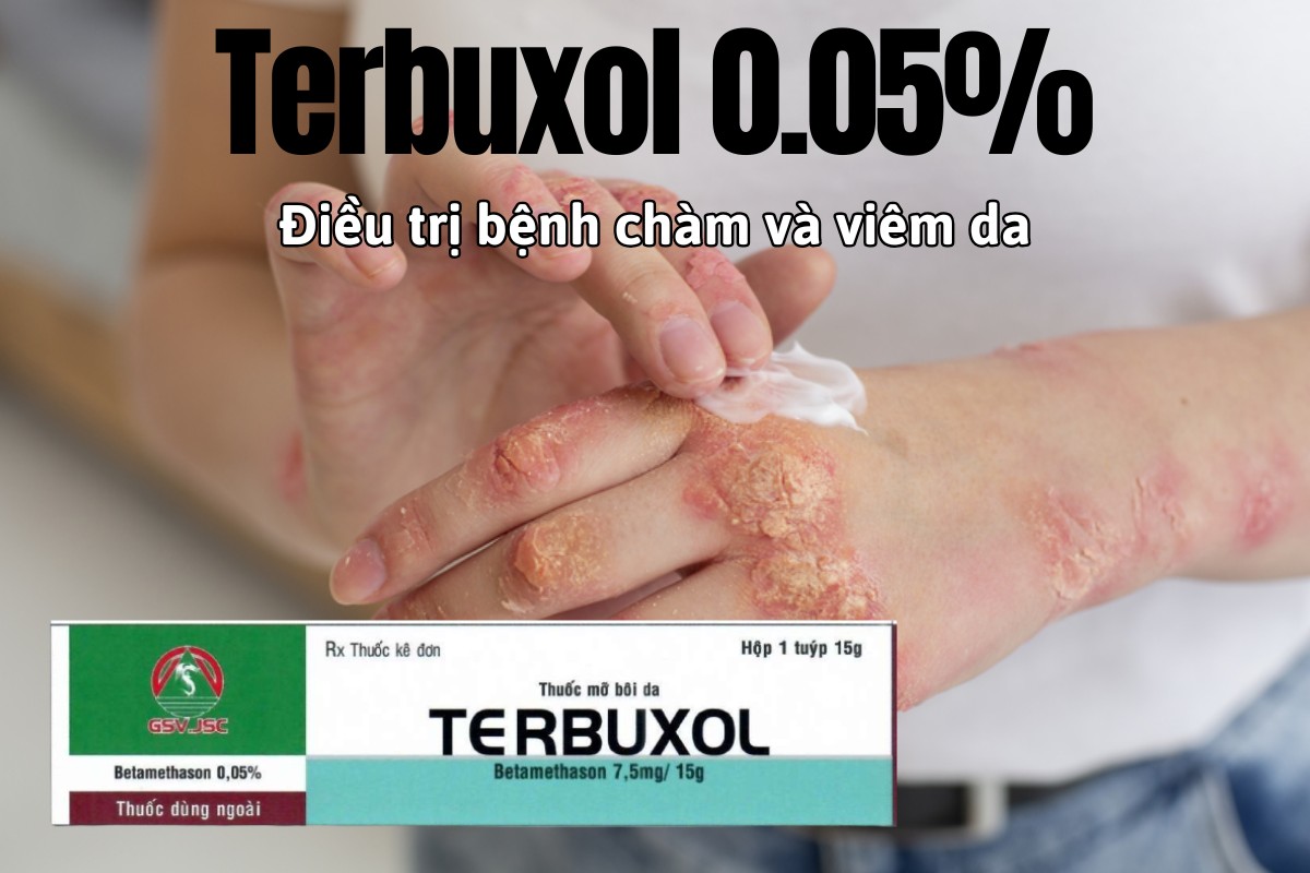 Thuốc Terbuxol 0.05% điều trị bệnh chàm và các bệnh viêm da