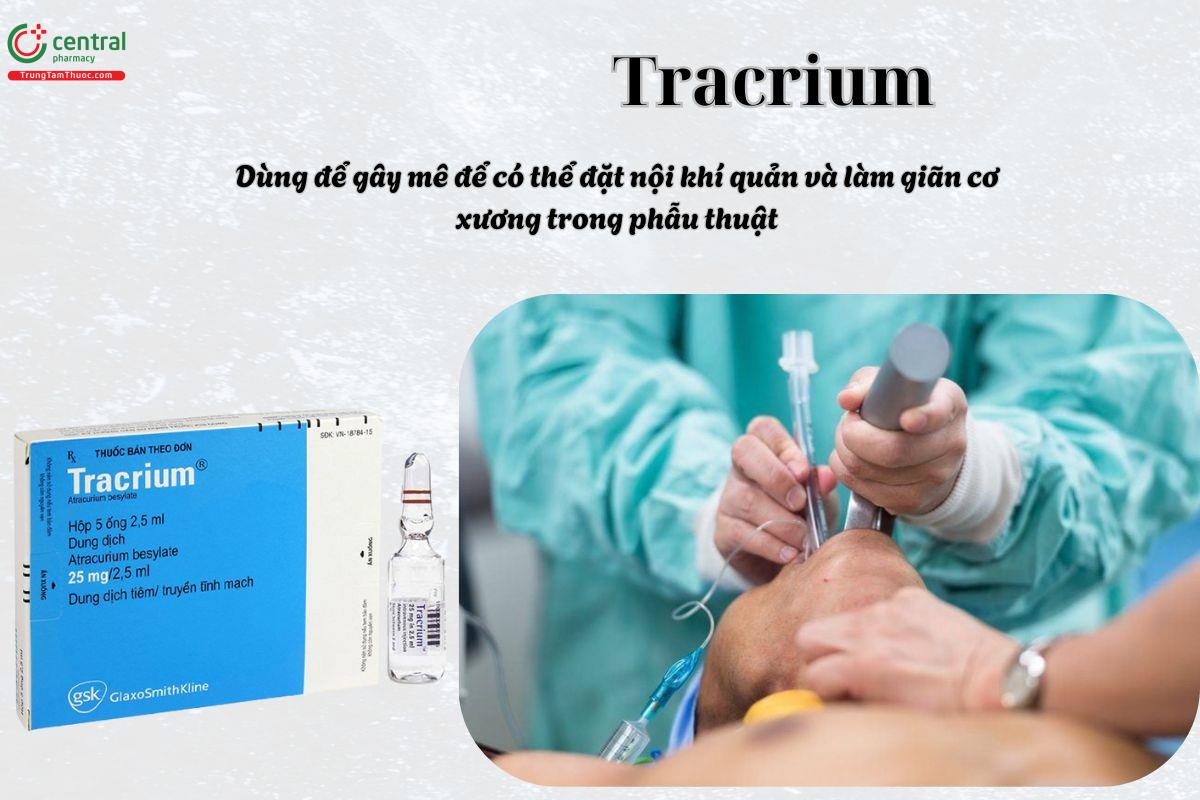 Thuốc Tracrium dùng để hỗ trợ gây mê trong đặt nội khí quản