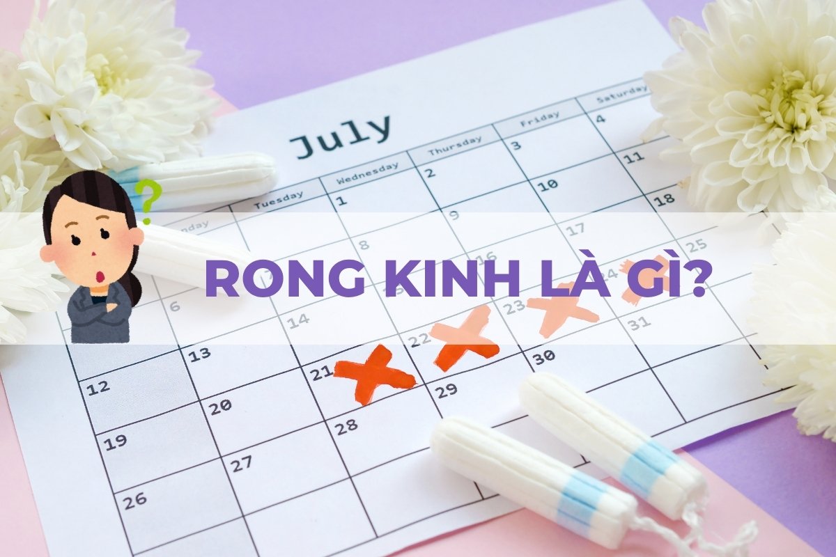 Rong kinh là gì?