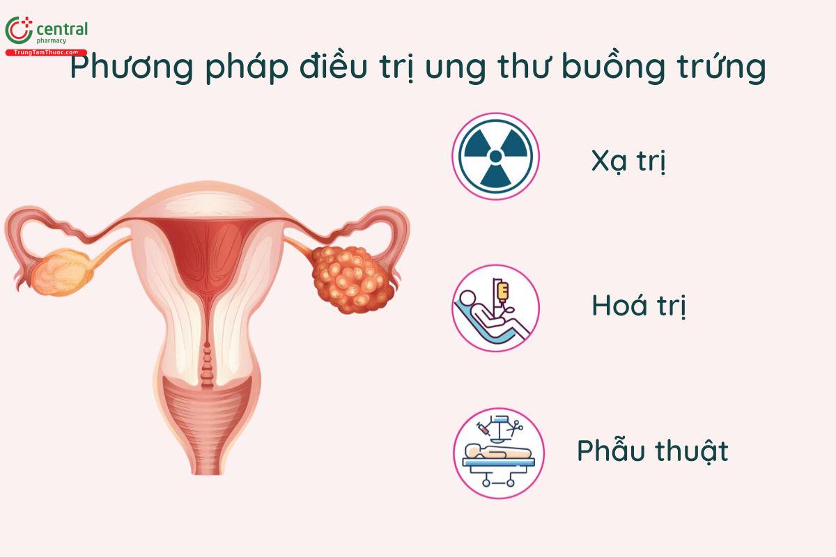 Phương pháp điều trị ung thư buồng trứng