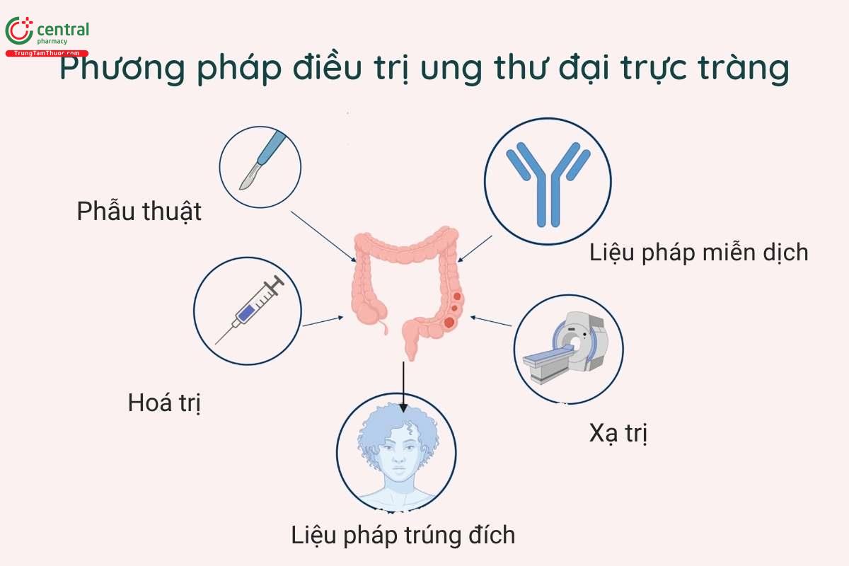 Phương pháp điều trị ung thư đại trực tràng