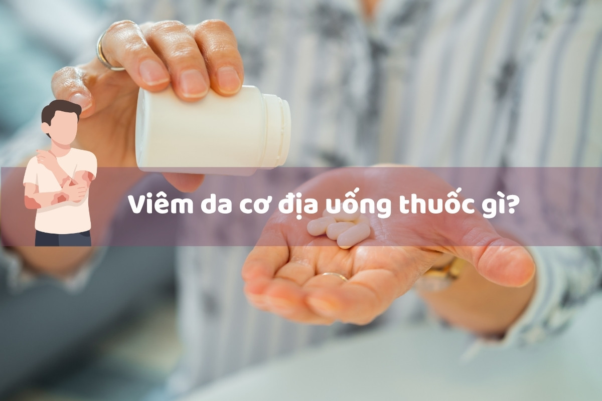 Viêm da cơ địa uống thuốc gì?