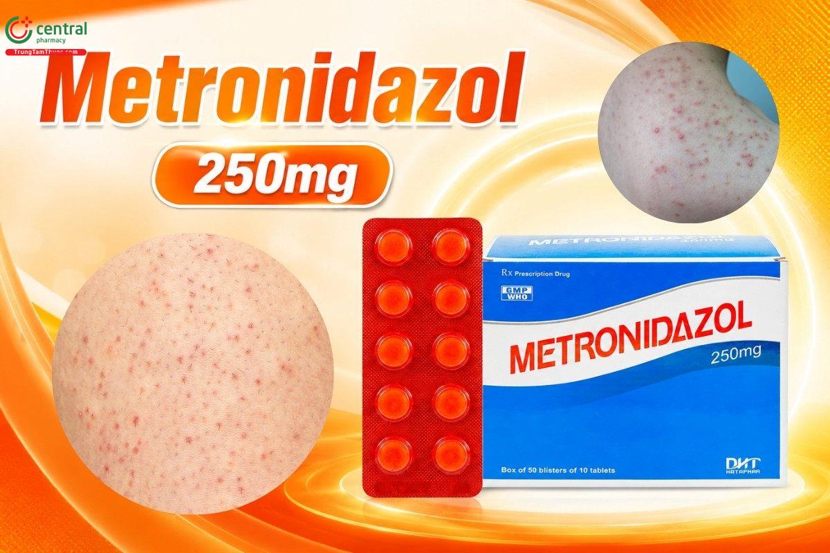 Kháng sinh metronidazol 250mg trị viêm nang lông nặng