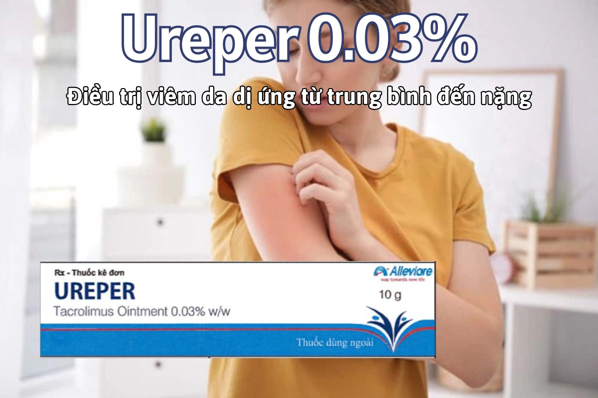 Thuốc Ureper 0.03% điều trị viêm da dị ứng mức độ trung bình đến nặng