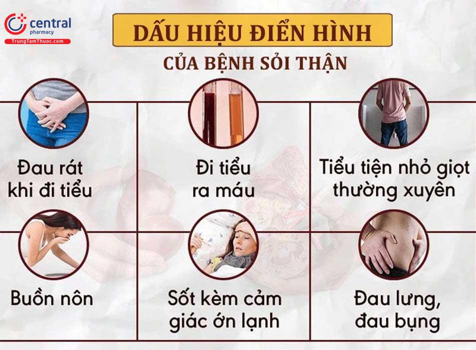 Một số dấu hiệu nhận biết bệnh sỏi thận