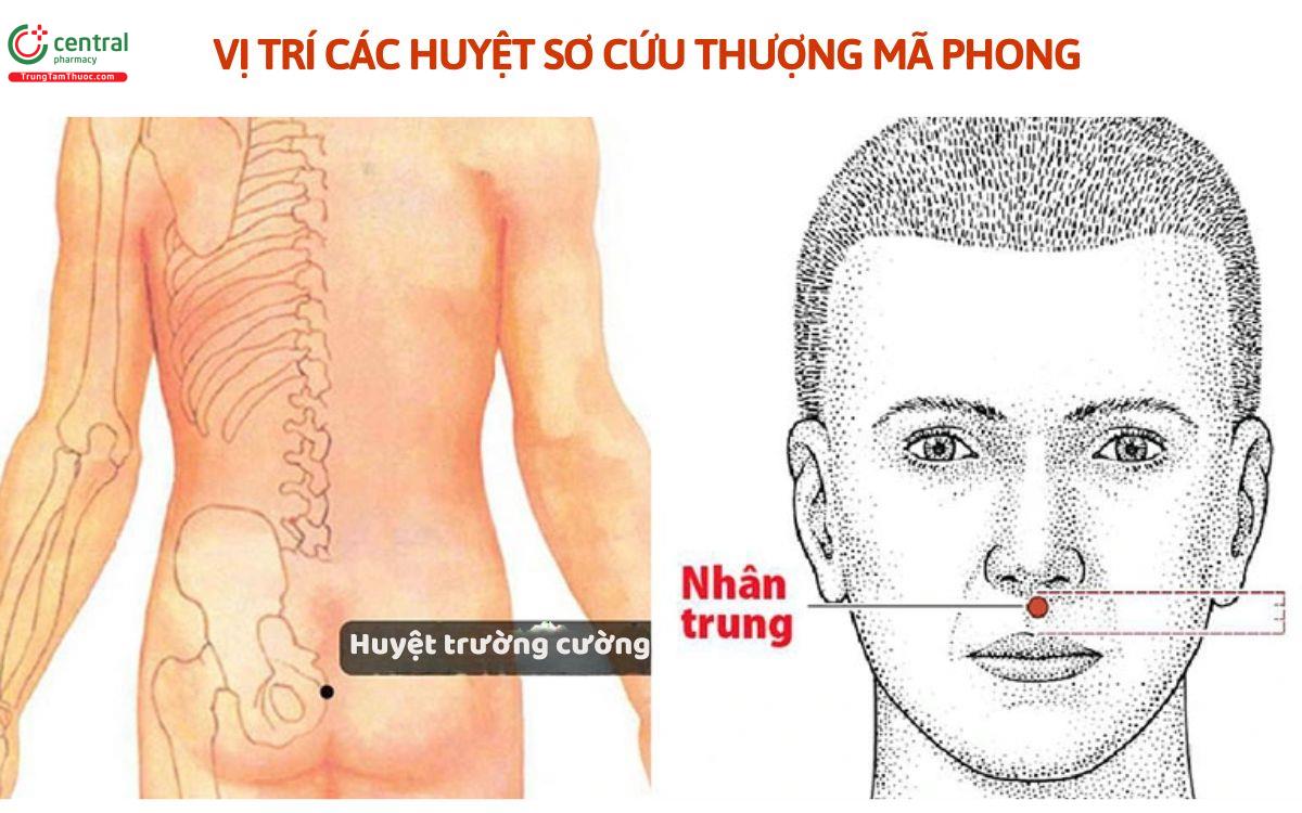 Vị trí huyệt sơ cứu thượng mã phong