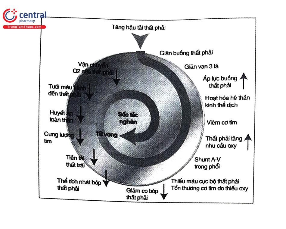 thuyên tắc phổi