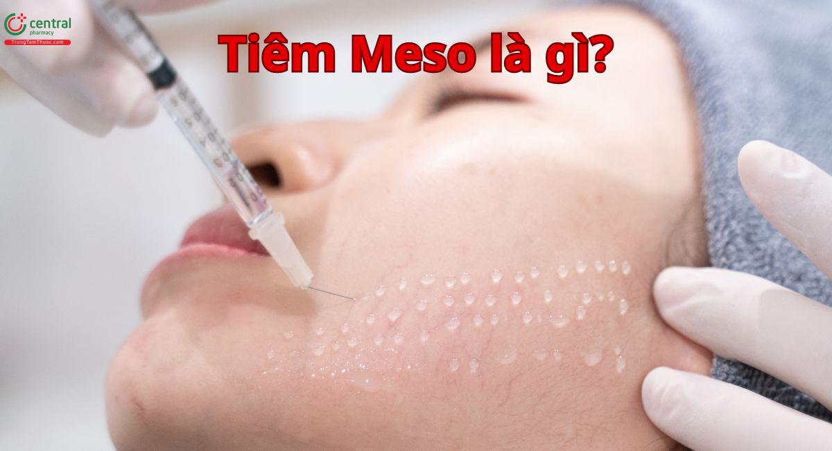 Tiêm Meso là gì?