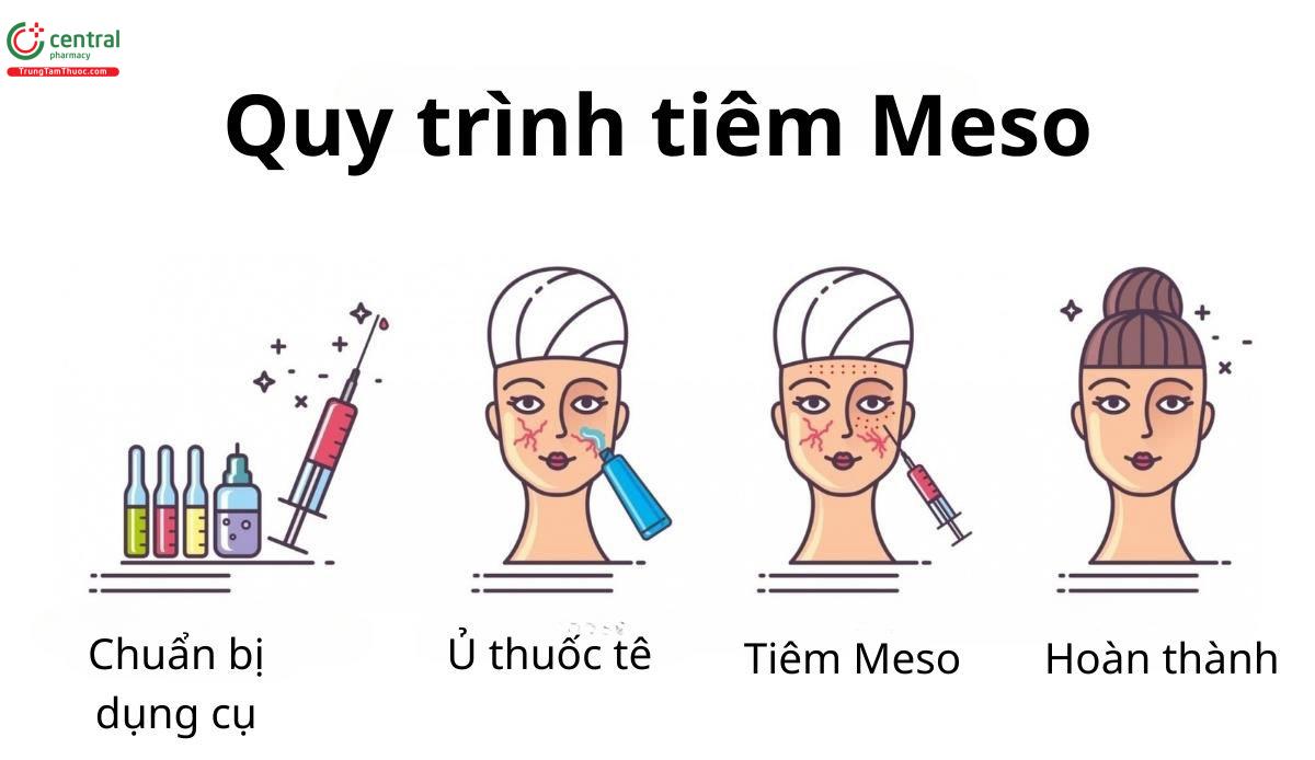 Quy trình tiêm Meso