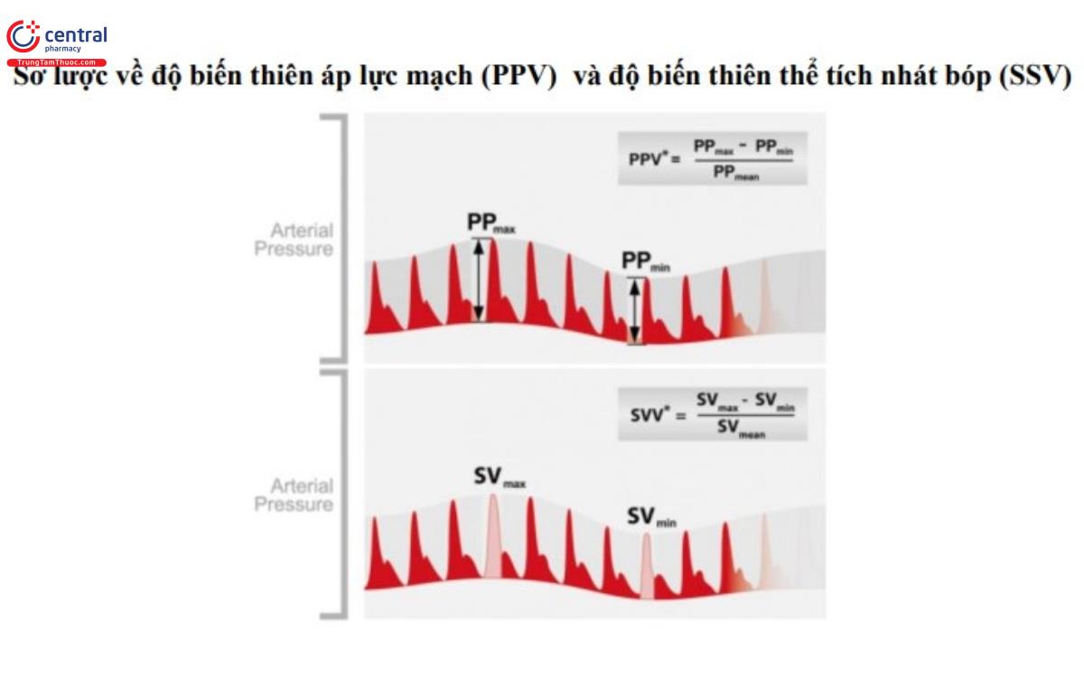 Sơ lược về độ biến thiên áp lực mạch (PPV) và độ biến thiên thể tích nhát bóp (SSV)