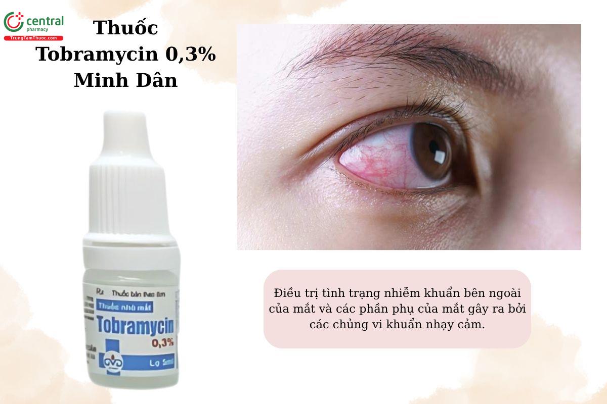 Chỉ định của thuốc Tobramycin 0,3% Minh Dân