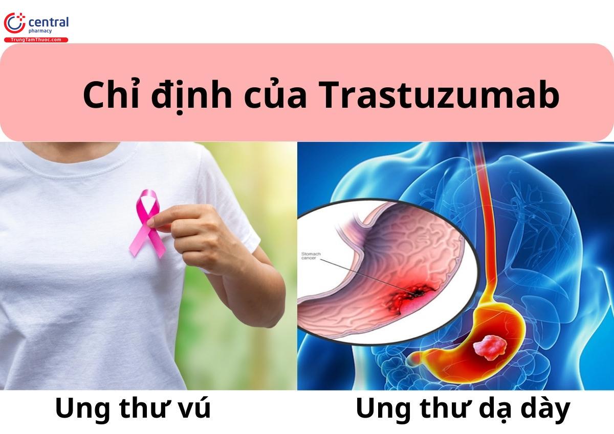 Chỉ định của Trastuzumab