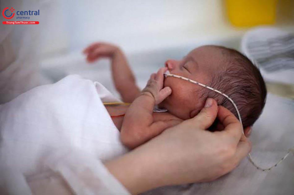 Trẻ sinh non có nguy cơ mắc bệnh màng trong gây suy hô hấp