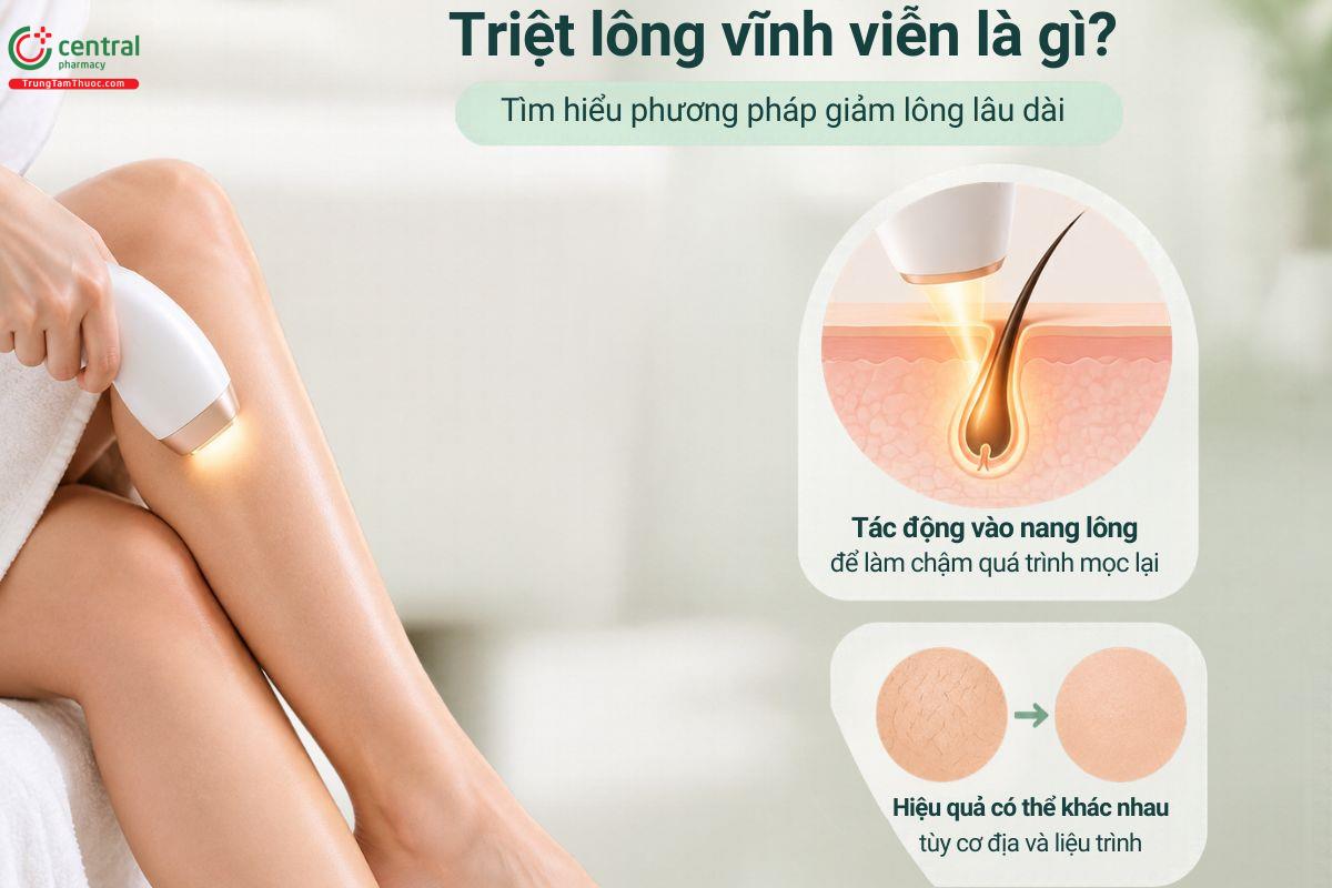 Triệt lông vĩnh viễn là gì?