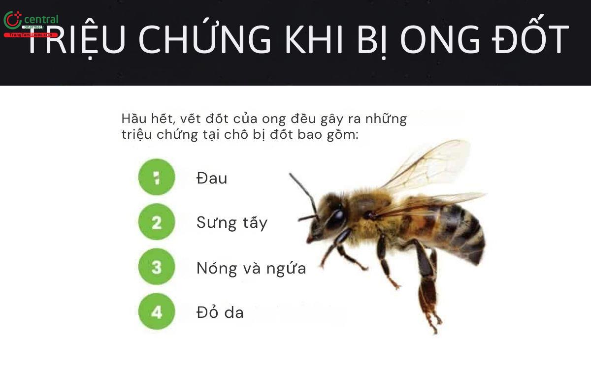 Triệu chứng khi bị ong đốt