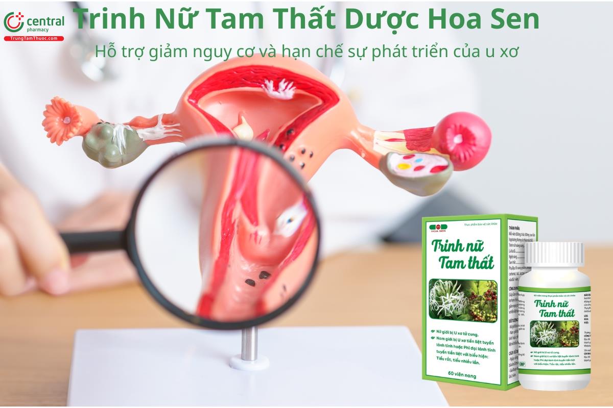Trinh Nữ Tam Thất hỗ trợ giảm nguy cơ và hạn chế sự phát triển u xơ