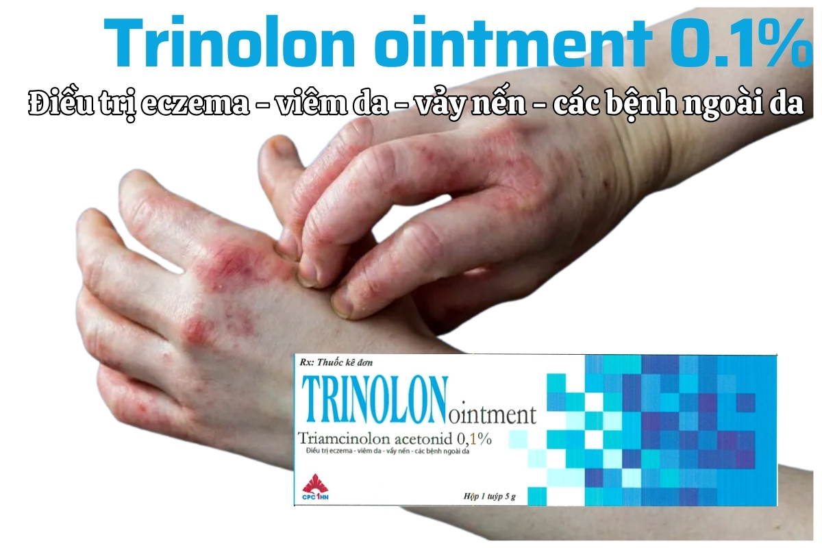 Thuốc Trinolon ointment 0.1% điều trị eczema - viêm da - vảy nến