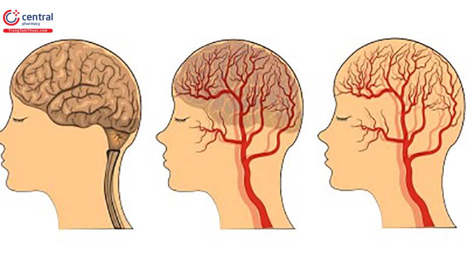 Hình ảnh tuần hoàn máu não