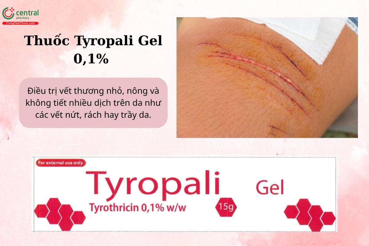 Chỉ định của thuốc Tyropali Gel 0,1%