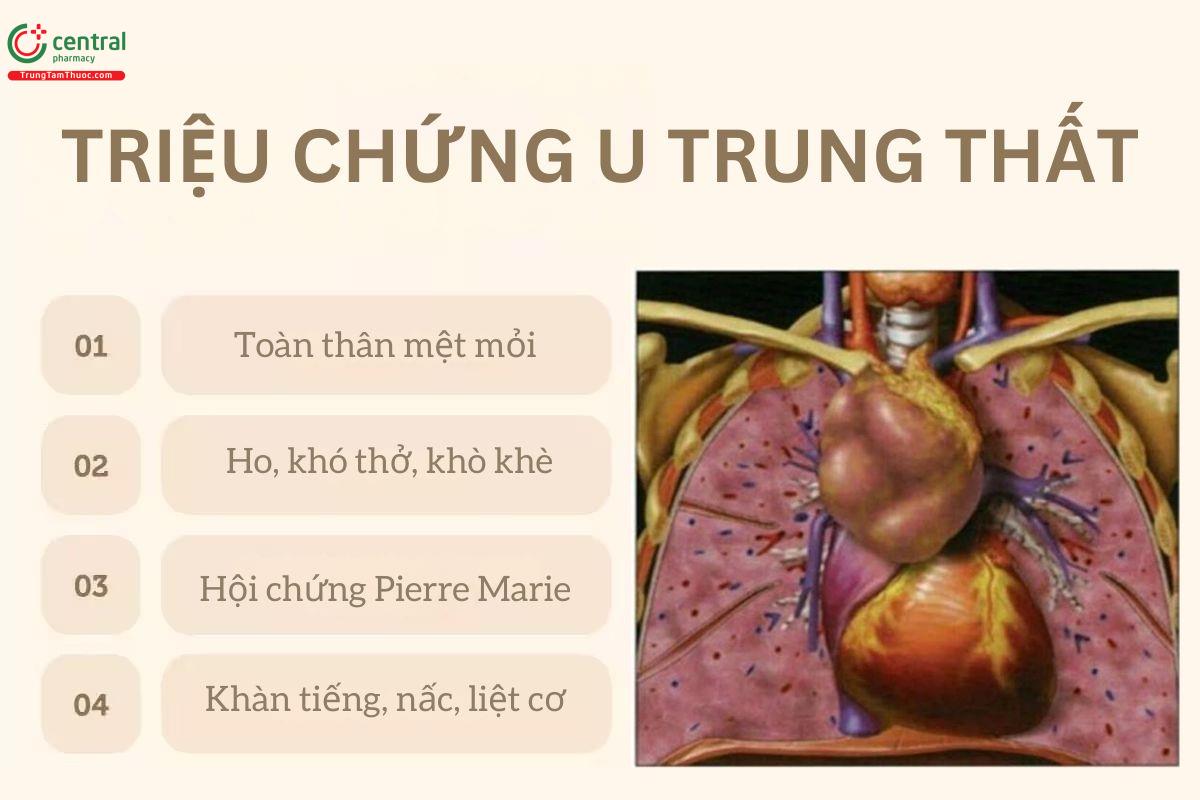 Triệu chứng u trung thất