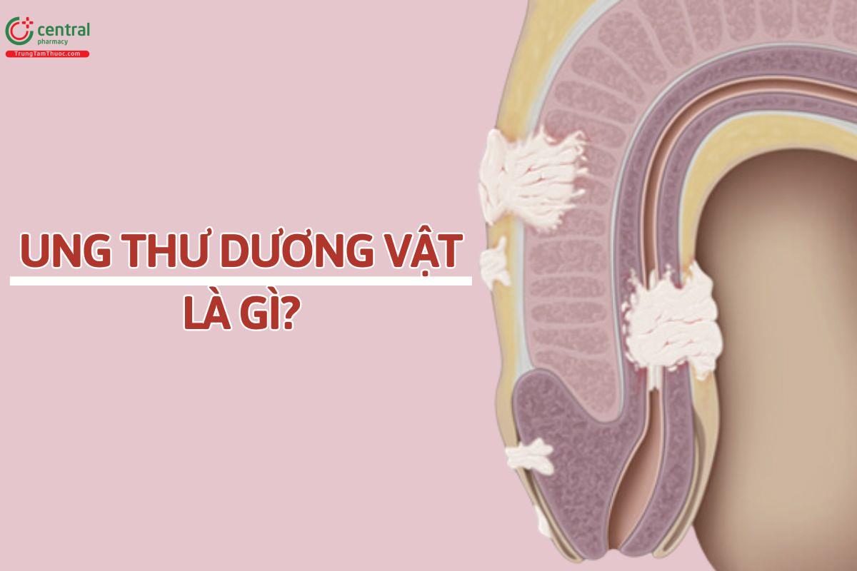 Ung thư dương vật là gì?