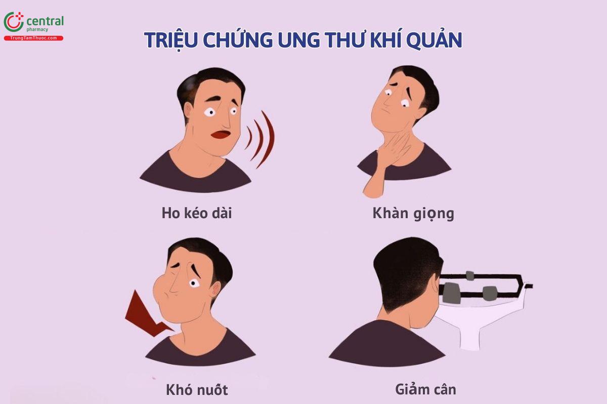 Triệu chứng của u ác khí quản