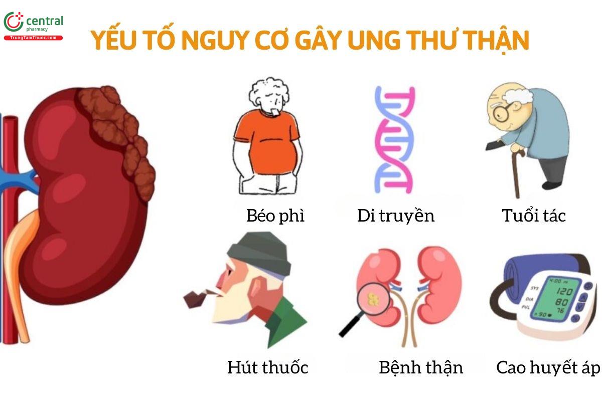 Yếu tố nguy cơ gây ung thư thận