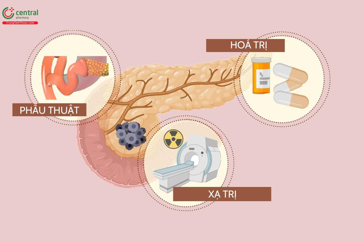 Phương pháp điều trị ung thư tuyến tuỵ