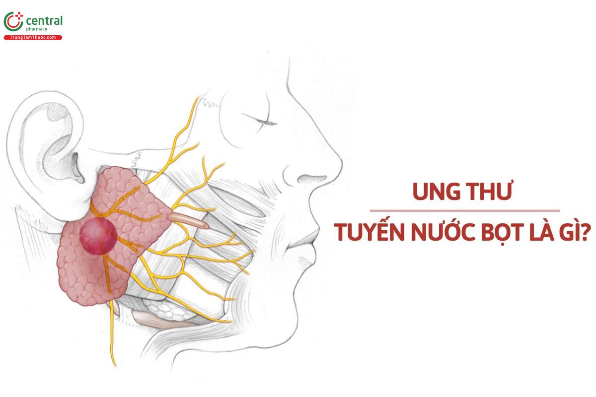 Ung thư tuyến nước bọt là gì?