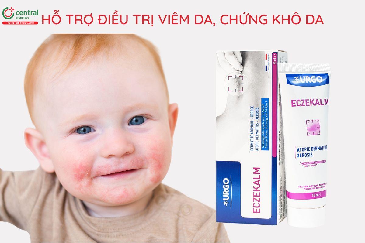 Công dụng của Urgo Eczekalm