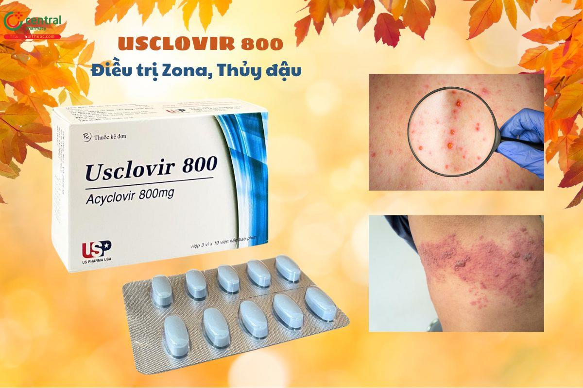 Thuốc Usclovir 800 - Điều trị zona, thủy đậu cho người lớn và trẻ em