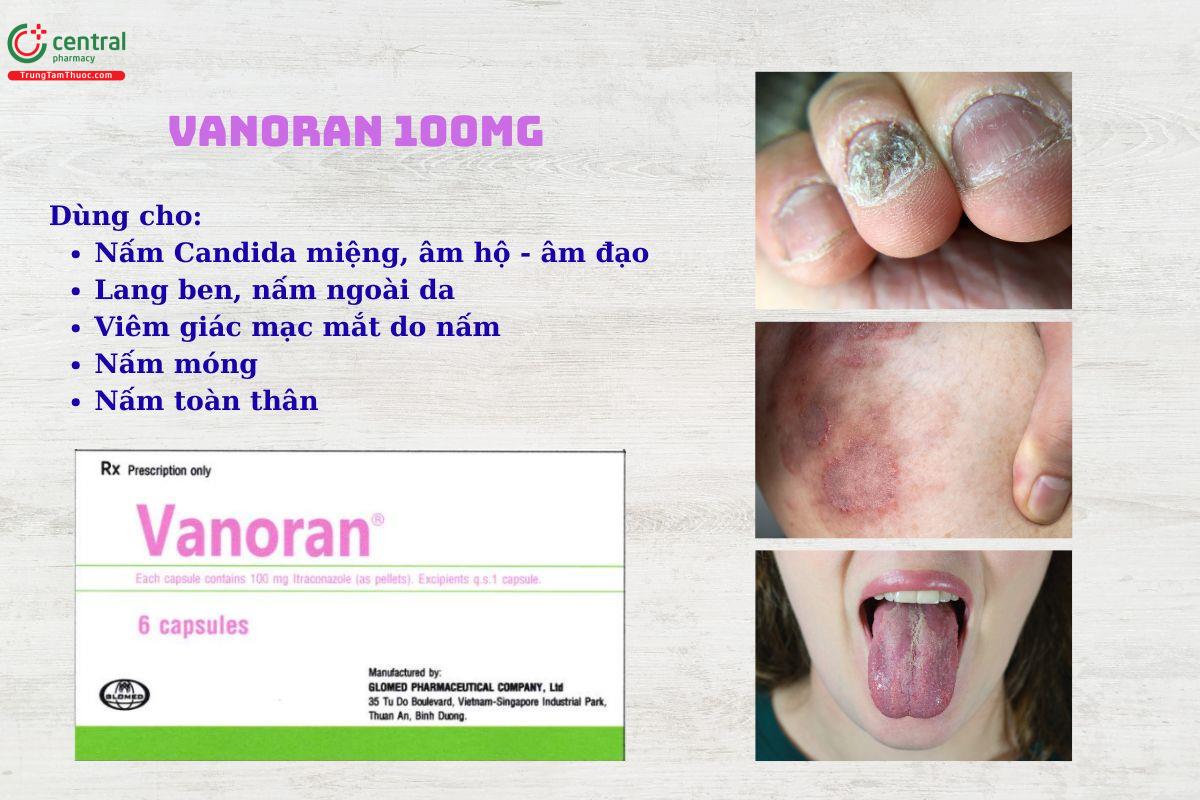 Thuốc Vanoran 100mg trị nấm da, lang ben, nấm móng, nấm toàn thân