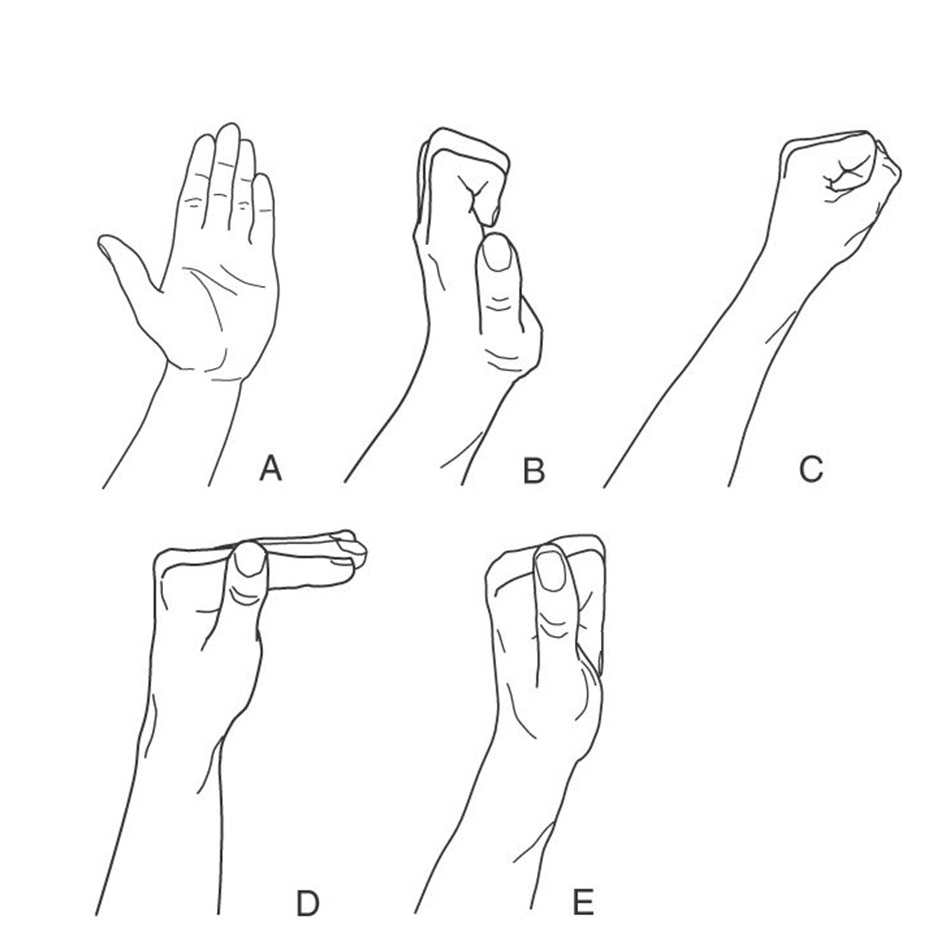 Vật lý trị liệu ống cổ tay
