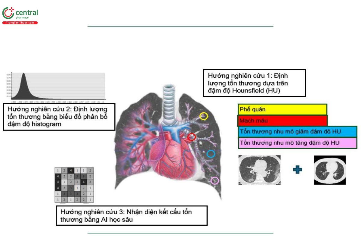 Hình 3. Hướng nghiên cứu định lượng bất thường mô kẽ phổi ILAs.