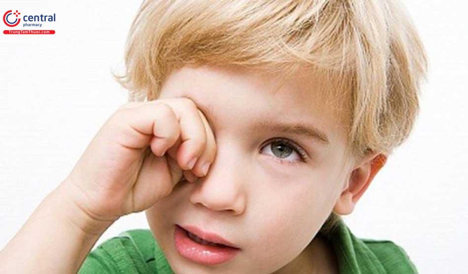 Không dụi tay vài mắt khi bị viêm kết mạc
