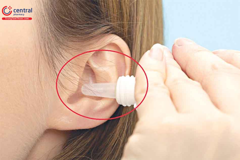 Thuốc nhỏ tai điều trị viêm ống tai ngoài