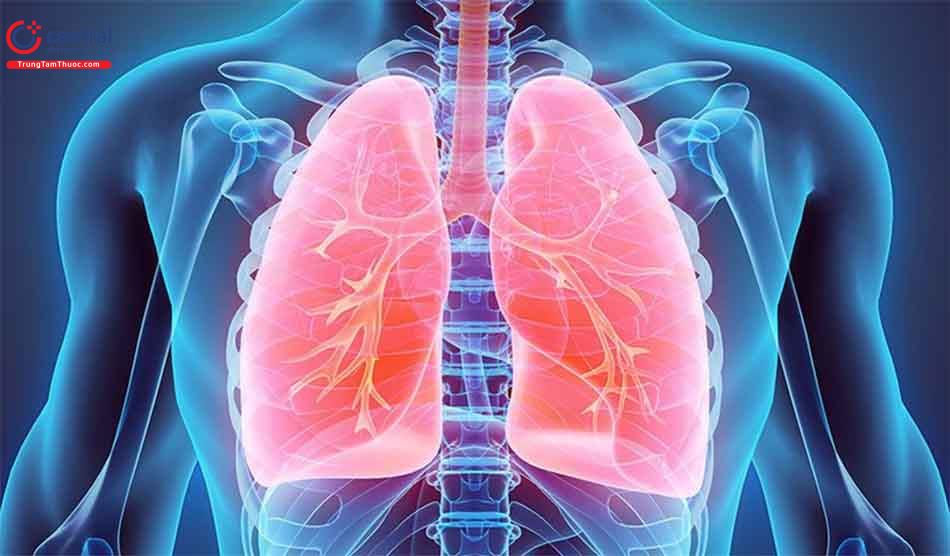 Viêm phổi không đáp ứng điều trị do nhiều nguyên nhân khác nhau