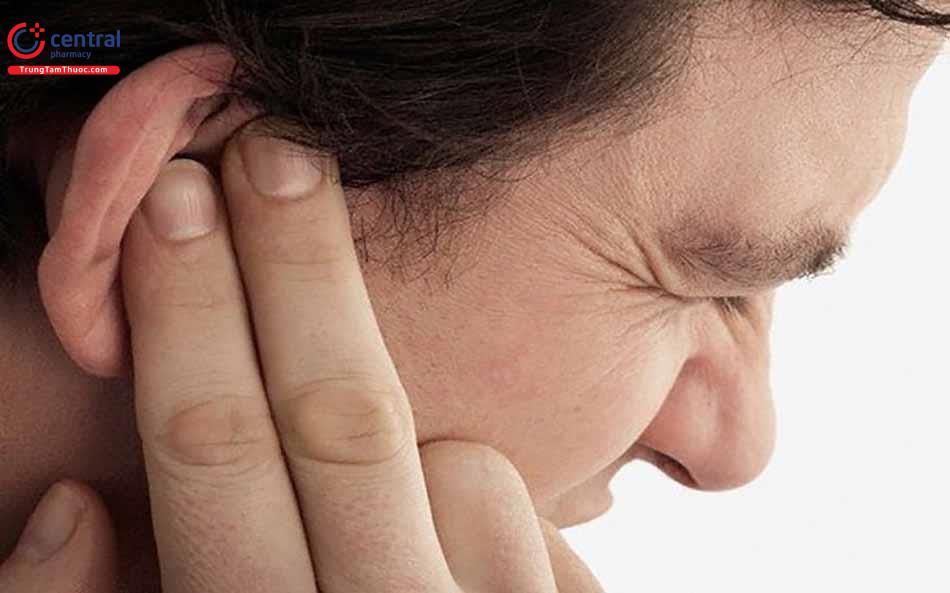Triệu chứng của viêm tai giữa mạn tính cholesteatoma