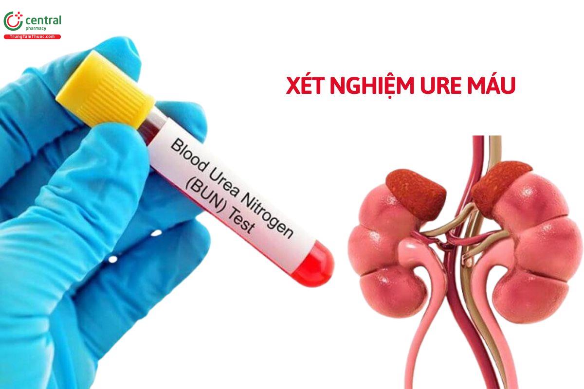 Xét nghiệm ure máu