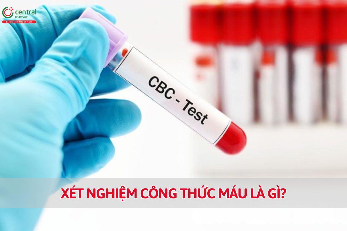 Xét nghiệm công thức máu là gì?