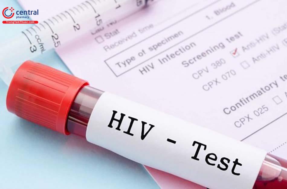 Người bệnh cần làm xét nghiệm máu chẩn đoán khi nghi ngờ nhiễm HIV.
