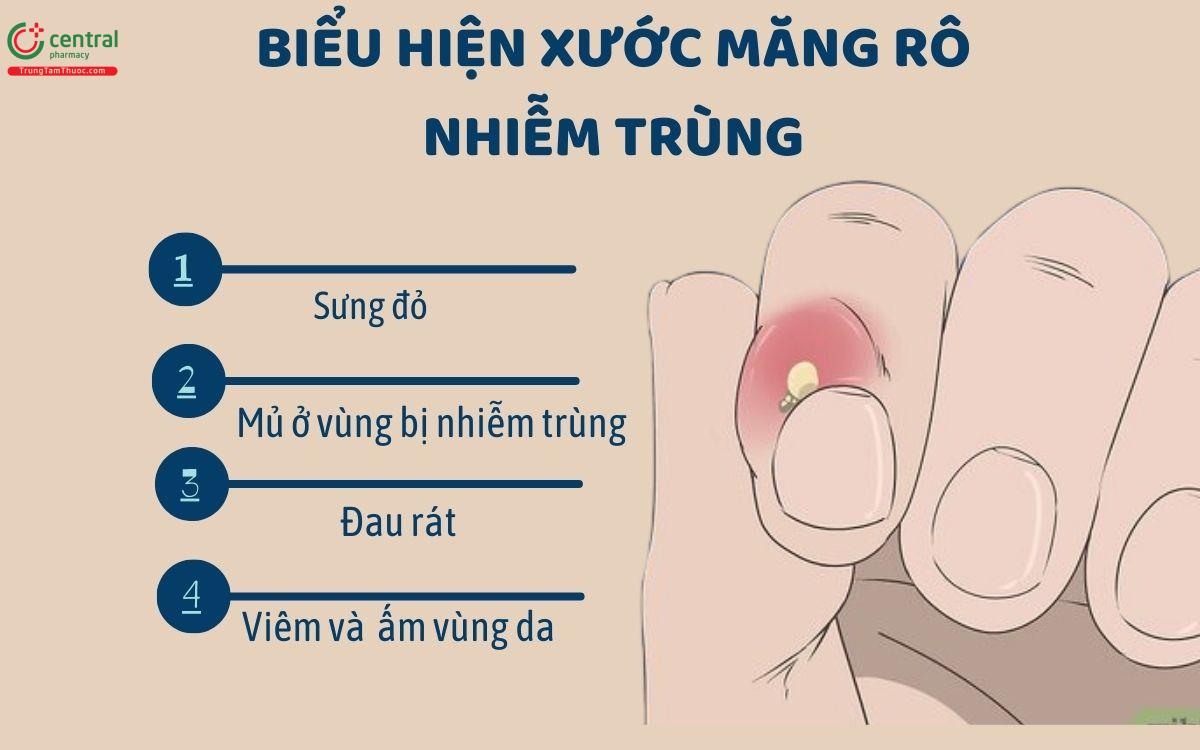 Điều trị xước măng rô bị nhiễm trùng, mưng mủ