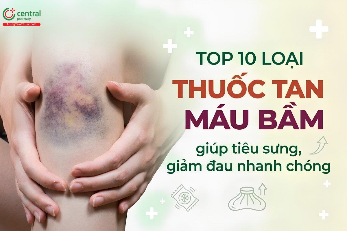 10 loại thuốc tan máu bầm giúp tiêu sưng, giảm đau nhanh chóng
