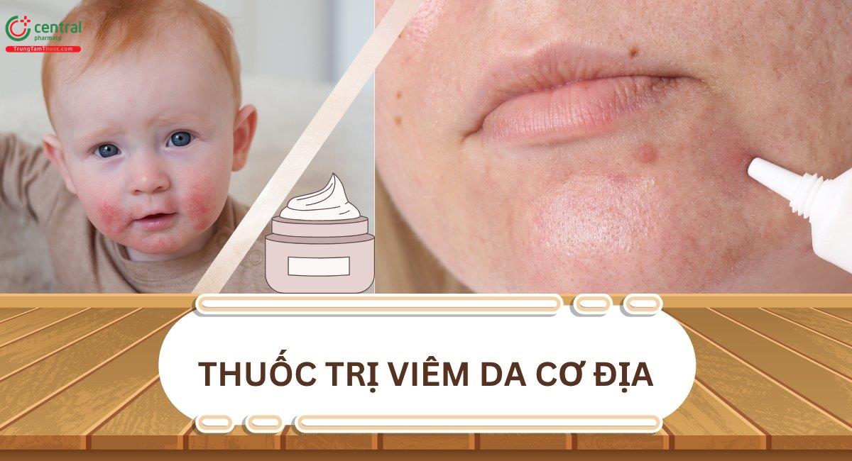 10 loại thuốc uống và thuốc bôi trị bệnh viêm da cơ địa hiệu quả